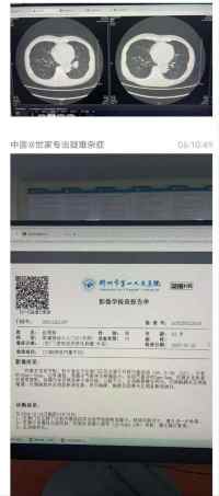 庆祝中国人民解放军建军98周年 中华名医——黎化雨