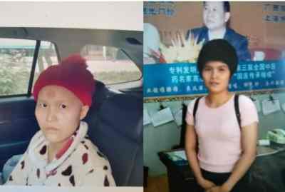 尿毒症乳腺癌不讲价钱凭良心给广西百色杨忠雅