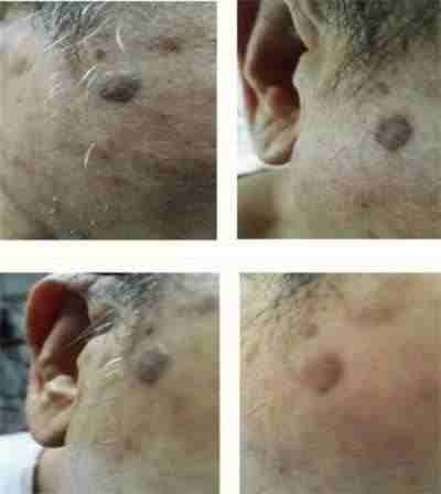 量子氢氧健康第一人长寿哥(廖永贵) 让科学量氢氧品牌走向世界!